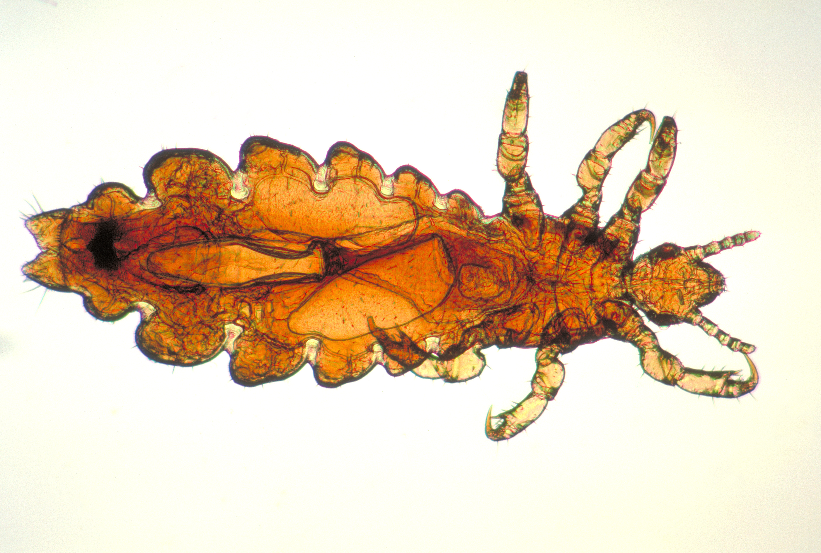 Magnified head louse. This teaching photograph is not actual size and does not show whether a child currently has live lice.
